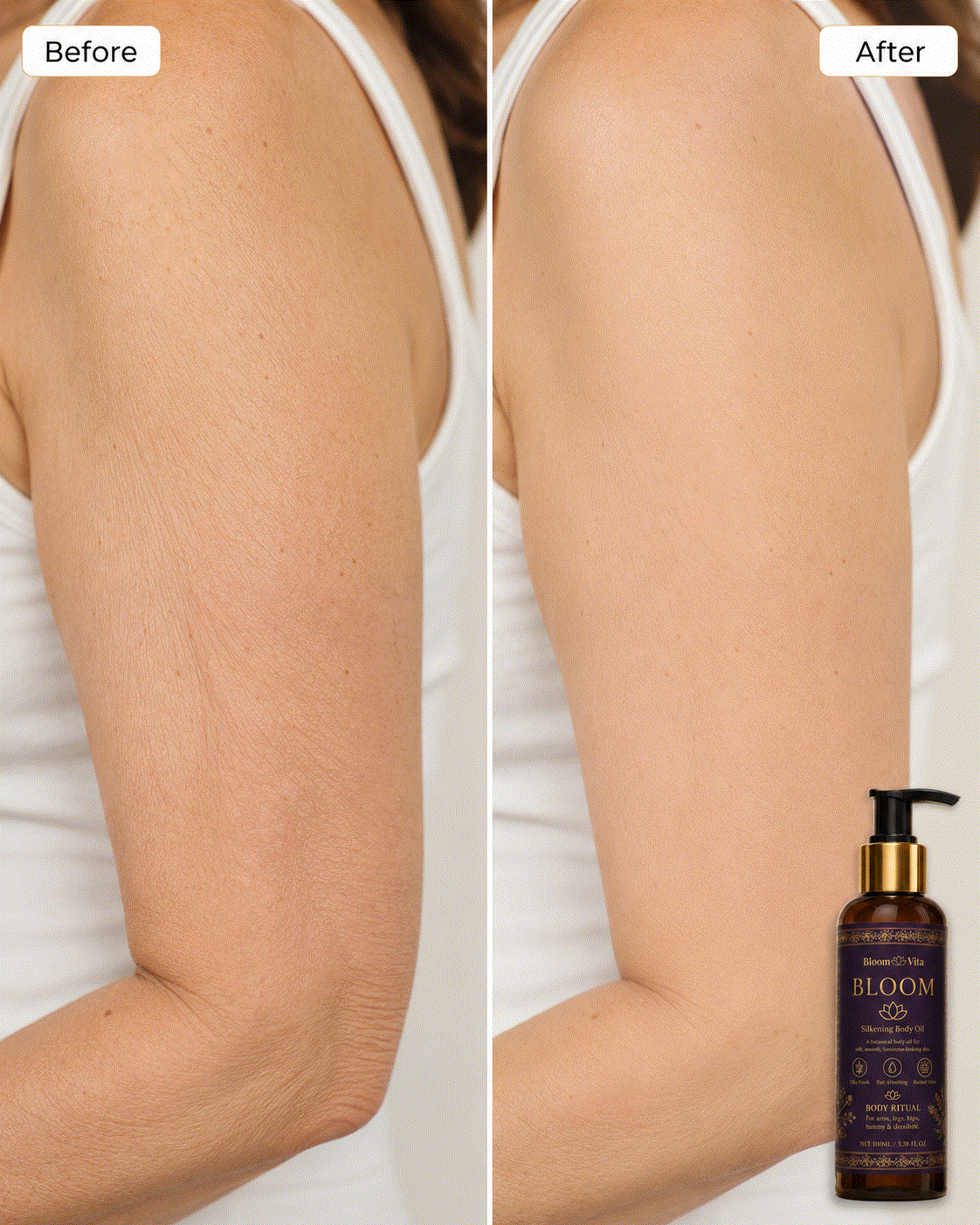 Before and after arm skin texture